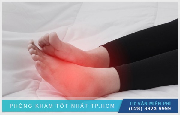Nóng rát lòng bàn chân do đâu? 
