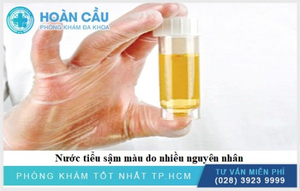 Nước tiểu màu vàng đậm là vì sao? Chữa như thế nào?
