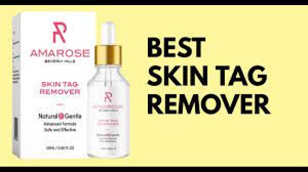 Paradise Skin Tag Removal - Does It Really Work For Your Skin?