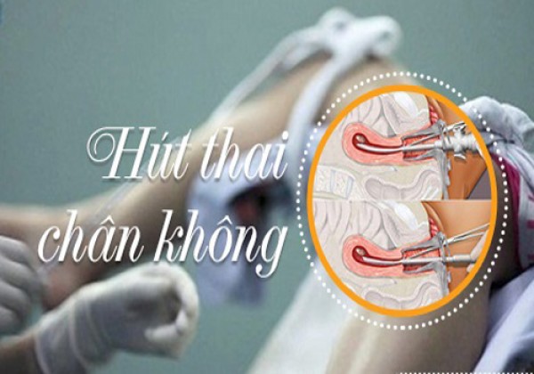 Phá thai 10 tuần tuổi bằng thuốc an toàn không đau