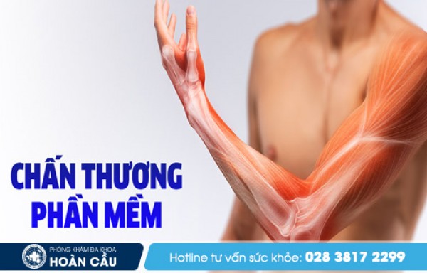 Phải làm gì khi bị chấn thương phần mềm? - Đa khoa Hoàn Cầu 