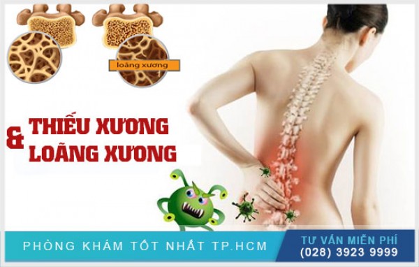 Phân biệt thiếu xương và loãng xương