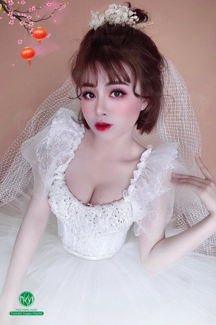 Phẫu thuật căng da ngực là gì