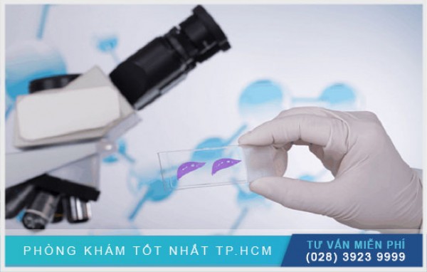 Phương pháp sinh thiết mụn cóc 