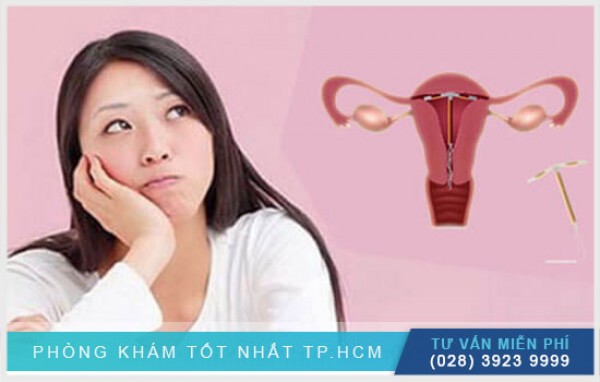 Quy trình đặt vòng tránh thai như thế nào? 