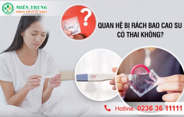 Rách bao cao su khi quan hệ có thai không
