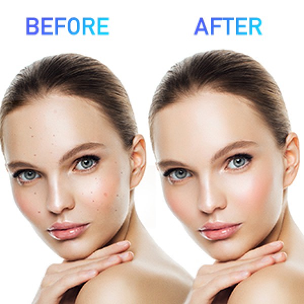 Radiant Cutis Skin Tag Remover Original Product!