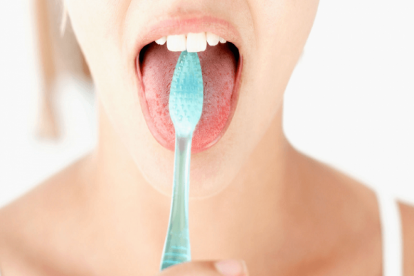 Răng sâu có tẩy trắng được không?