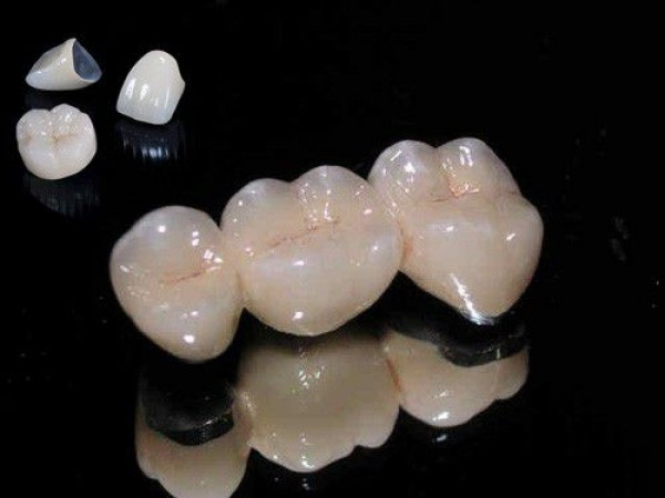 Răng sứ thường có tốt không?