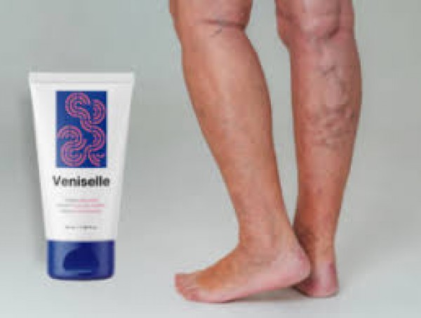 Reseñas de Veniselle: ¿Crema legítima para las venas varicosas que funciona?