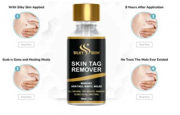 Silky Skin Tag Remover Reviews [Urgent Update!] Shocking Side Effects or Real Customer Results?
