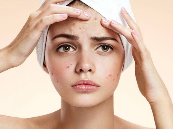 skincare mai khong het mun & những cách skincare trị mụn hiệu quả