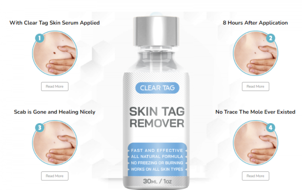 Smooth and Clear Skin: ClearTag Skin Tag Remover Serum