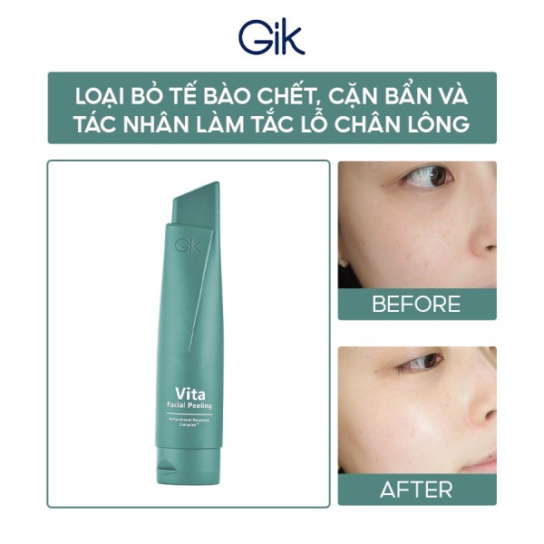 Tẩy tế bào chết vật lý Gik Vita Bright Nutrition Facial Peeling và những điều bạn chưa biết