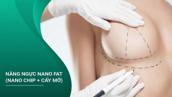 Thẩm mỹ nâng ngực ở đâu đẹp kết hợp trả góp hỗ trợ tài chính