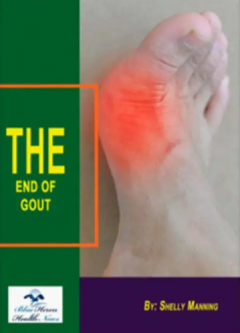 The End of Gout Reviews (BUYERS BEWARE) Real User’s Shelly Manning The End of Gout Review!