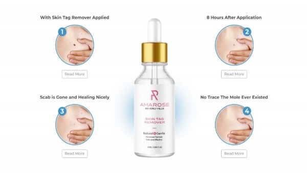 The Future According to Paradise Skin Tag Remover Experts