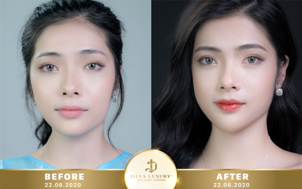 Thêu chân mày nam giá tốt và uy tín tại Viện Thẩm Mỹ Diva