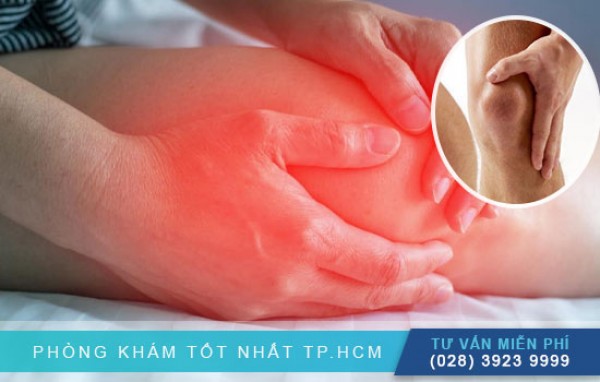 Thông tin về bệnh giả gout 