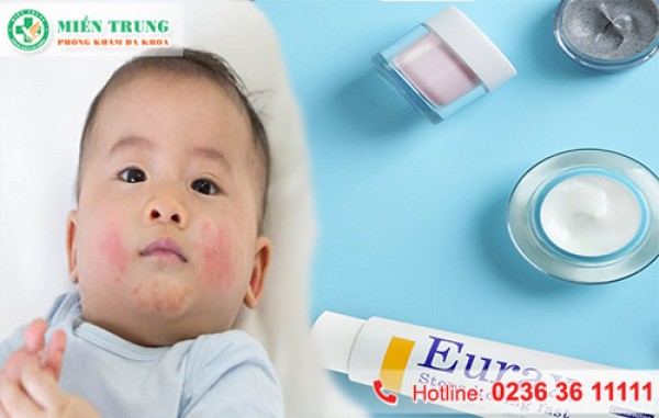 Thuốc đặc trị bệnh ghẻ ngứa  