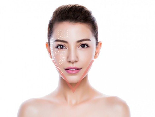 Tìm hiểu căng da mặt bằng chỉ collagen là gì?