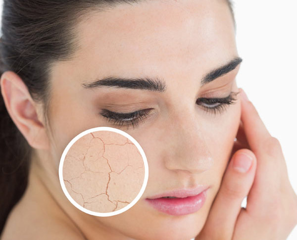 Tìm hiểu căng da mặt có hại không?