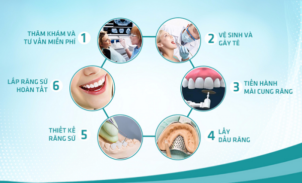 Tìm hiểu quy trình bọc răng sứ là gì?