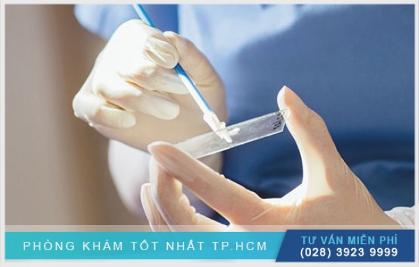 Tìm hiểu xét nghiệm pap