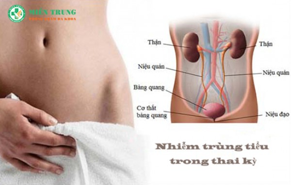 Tình trạng nhiễm trùng tiểu trong thai kỳ 