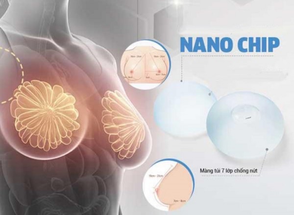 Trợ giá nâng ngực ở bệnh viện thẩm mỹ bằng đầu tư toàn quốc