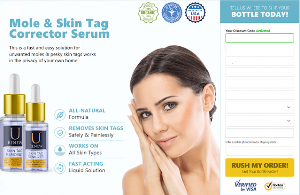 U Renew Skin Tag Remover - Get Young Skin Back with Against Maturing Cream!