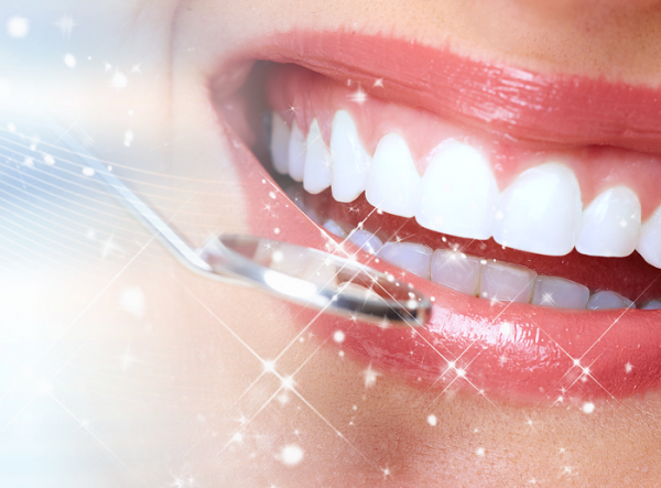 Ưu điểm của bọc răng sứ thẩm mỹ là gì?