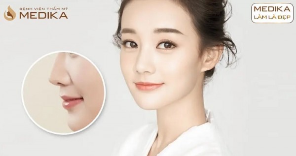 Vật liệu nâng mũi tái cấu trúc tốn bao nhiêu tiền theo loại sụn