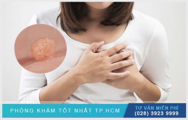 Vì sao nhũ hoa nổi mụn thịt? 