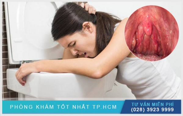 Viêm họng buồn nôn 