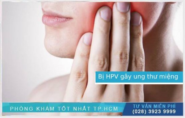 Virus HPV gây ung thư miệng
