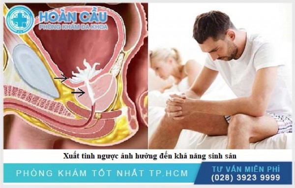 Xuất tinh ngược: Nguyên nhân, triệu chứng cùng cách điều trị